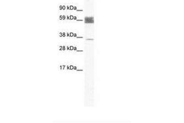 ZNF713 抗体  (AA 118-167)