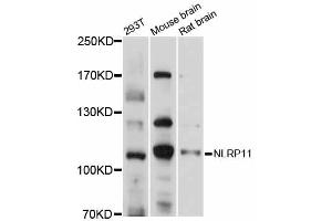 Western blot analysis of extracts of various cell lines, using NLRP11 antibody (ABIN5998353) at 1/1000 dilution. (NLRP11 Antikörper)