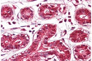 IHC Suggested Anti-PTDSR antibody  Titration: 5ug/ ml Positive Control: Breast (JMJD6 Antikörper  (Middle Region))