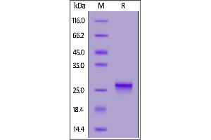 SDS-PAGE (SDS) image for Interleukin 17C (IL17C) (AA 19-197) (Active) protein (His tag,AVI tag,Biotin) (ABIN6923157)