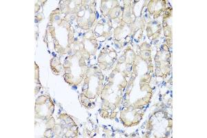 Immunohistochemistry of paraffin-embedded human stomach using AHCYL1 antibody (ABIN5975313) at dilution of 1/100 (40x lens). (AHCYL1 Antikörper)
