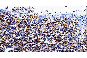 Immunohistochemistry of paraffin-embedded Human tosil tissue using IL10RA Polyclonal Antibody at dilution 1:60 (IL-10RA Antikörper)
