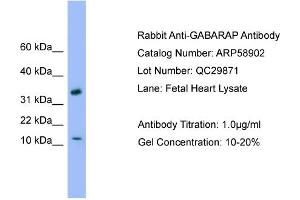 Western Blotting (WB) image for anti-GABA(A) Receptor-Associated Protein (GABARAP) (C-Term) antibody (ABIN2787872)