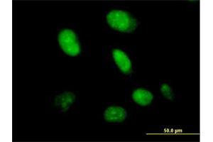 Immunofluorescence of purified MaxPab antibody to CXorf43 on HeLa cell. (HDX Antikörper  (AA 1-690))