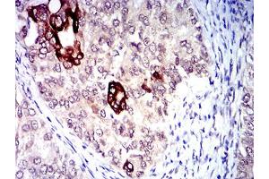 Immunohistochemistry (IHC) image for anti-Chemokine (C-X-C Motif) Receptor 3 (CXCR3) antibody (ABIN5611329)
