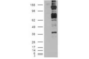 Image no. 2 for anti-Caspase Recruitment Domain Family, Member 11 (CARD11) (C-Term) antibody (ABIN374314) (CARD11 Antikörper  (C-Term))