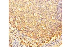 Immunohistochemistry of paraffin-embedded human tonsil tissue using ABIN7148034 at dilution of 1:100 (CBWD2 Antikörper  (AA 96-395))