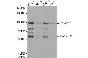 Western Blotting (WB) image for anti-Ubiquitin-Like with PHD and Ring Finger Domains 2, E3 Ubiquitin Protein Ligase (UHRF2) (AA 76-359) antibody (ABIN3023235)