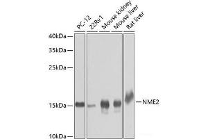 Western blot analysis of extracts of various cell lines using NME2 Polyclonal Antibody at dilution of 1:1000. (NME2 Antikörper)