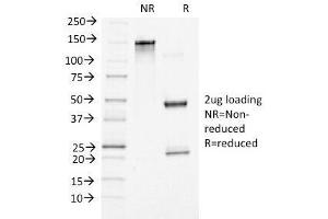 SDS-PAGE (SDS) image for anti-Catenin, beta (CATNB) (C-Term) antibody (ABIN4949473)