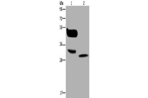 Western Blotting (WB) image for anti-Melanoma Antigen Family A, 8 (MAGEA8) antibody (ABIN2423755) (MAGEA8 Antikörper)