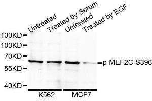 Western blot analysis of extracts from 24 hours starved 3T3 cells using Phospho-MEF2C-S396 antibody. (MEF2C Antikörper  (pSer396))
