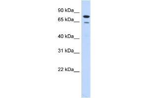 WB Suggested Anti-RMI1 Antibody Titration:  0. (RMI1 Antikörper  (N-Term))