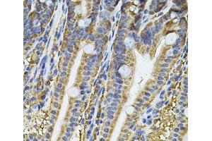 Immunohistochemistry of paraffin-embedded Mouse intestine using NFU1 Polyclonal Antibody at dilution of 1:100 (40x lens). (NFU1 Antikörper)