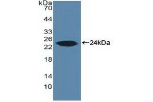 Western blot analysis of recombinant Human ARO. (Aromatase Antikörper  (AA 196-373))