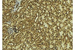 ABIN6277660 at 1/100 staining Mouse kidney tissue by IHC-P. (DCLRE1C Antikörper  (C-Term))