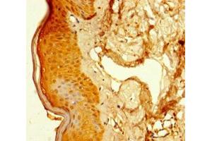 Immunohistochemistry of paraffin-embedded human skin tissue using ABIN7152513 at dilution of 1:100 (SUPT16H Antikörper  (AA 187-282))