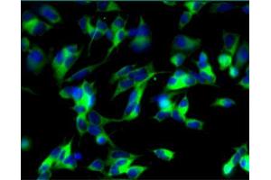 Immunofluorescent staining of undifferentiated (left) and differentiated (right) SH-SY5Y cells. (MAP2 Antikörper  (AA 19-219))