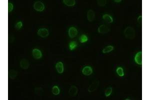 Anti-GSC mouse monoclonal antibody (ABIN2452379) immunofluorescent staining of HeLa cells transiently transfected by pCMV6-ENTRY GSC (RC209586) (GSC Antikörper  (AA 107-257))