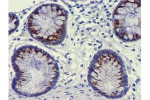 Immunohistochemistry (IHC) image for anti-Golgi Membrane Protein 1 (GOLM1) antibody (ABIN1498494) (GOLM1 Antikörper)