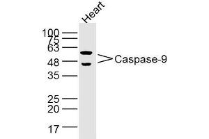 Heart lysates probed with Caspase-9 Polyclonal Antibody, Unconjugated  at 1:300 dilution and 4˚C overnight incubation.