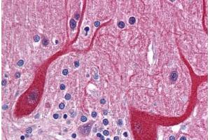 Human Brain, Cerebellum: Formalin-Fixed, Paraffin-Embedded (FFPE) (PKDCC Antikörper  (Internal Region))