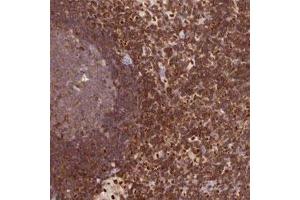 Immunohistochemical staining of human lymph node with DENND1C polyclonal antibody  shows strong cytoplasmic positivity in non-germinal center cells at 1:200-1:500 dilution. (DENND1C Antikörper)