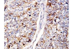 Immunohistochemistry (IHC) image for anti-Cell Division Cycle 25 Homolog B (S. Pombe) (CDC25B) (AA 541-559) antibody (ABIN3030454)