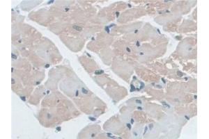 Immunohistochemistry (IHC) image for anti-NLR Family, Pyrin Domain Containing 3 (NLRP3) (AA 671-1033) antibody (ABIN7443710)