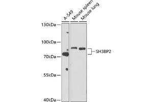 Western blot analysis of extracts of various cell lines, using SH3BP2 antibody (ABIN6130687, ABIN6147721, ABIN6147722 and ABIN6214417) at 1:1000 dilution. (SH3BP2 Antikörper  (AA 392-561))