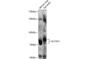 Western blot analysis of extracts of various cell lines, using SLC15 antibody (0246) at 1:1000 dilution. (SLC15A1 Antikörper  (AA 600-700))