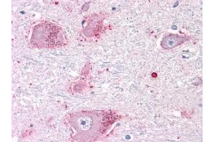 Immunohistochemical staining of Brain (Neurons and Glia) using anti- CHRM3 antibody ABIN122325 (CHRM3 Antikörper  (C-Term))