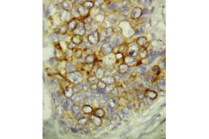 Immunohistochemistry (IHC) image for anti-Caspase 6, Apoptosis-Related Cysteine Peptidase (CASP6) (AA 24-44), (N-Term) antibody (ABIN3043219)