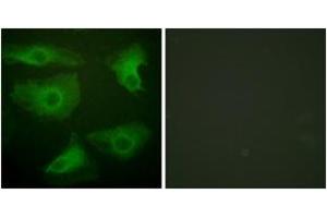 Immunofluorescence analysis of HeLa cells, using IkappaB-epsilon (Phospho-Ser22) Antibody. (IkappaB-epsilon Antikörper  (pSer22))