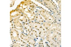 Immunohistochemistry (Paraffin-embedded Sections) (IHC (p)) image for anti-Adenosine Kinase (ADK) antibody (ABIN7072953)
