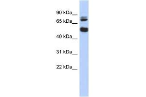 WB Suggested Anti-MGC42105 Antibody Titration: 0. (NIM1 Antikörper  (Middle Region))