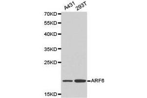 Western Blotting (WB) image for anti-ADP-Ribosylation Factor 6 (ARF6) antibody (ABIN1871073) (ARF6 Antikörper)