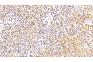 Immunohistochemistry (IHC) image for anti-Transforming Growth Factor, beta Receptor III (TGFBR3) (AA 469-724) antibody (ABIN7442234)