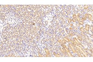 Detection of TGFbR3 in Mouse Kidney Tissue using Polyclonal Antibody to Transforming Growth Factor Beta Receptor III (TGFbR3) (TGFBR3 Antikörper  (AA 469-724))