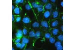 IF analysis of beta Catenin using anti-beta Catenin antibody (ABIN5693091).