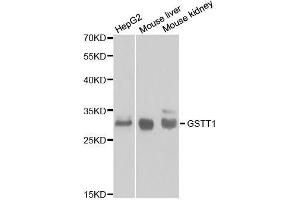 Western blot analysis of extracts of various cell lines, using GSTT1 antibody. (GSTT1 Antikörper  (AA 1-240))