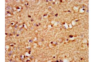 IHC image of ABIN7172623 diluted at 1:300 and staining in paraffin-embedded human brain tissue performed on a Leica BondTM system. (SOX3 Antikörper  (AA 4-118))