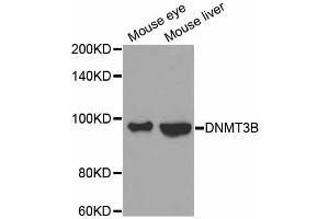 Western blot analysis of extracts of various cell lines, using DNMT3B antibody. (DNMT3B Antikörper)
