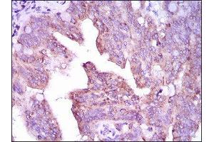 Immunohistochemistry (IHC) image for anti-Calcium/calmodulin-Dependent Protein Kinase IV (CAMK4) (AA 35-292) antibody (ABIN1845379) (CAMK4 Antikörper  (AA 35-292))