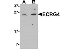 Western blot analysis of ECRG4 in HeLa cell lysate with ECRG4 Antibody  at (A) 1 and (B) 2 μg/mL