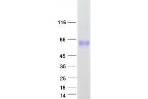 Western Blotting (WB) image for Docking Protein 3 (DOK3) (Transcript Variant 1) protein (Myc-DYKDDDDK Tag) (ABIN2719652)