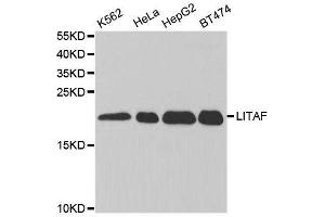 Western blot analysis of extracts of various cell lines, using LITAF antibody. (LITAF Antikörper  (AA 1-161))
