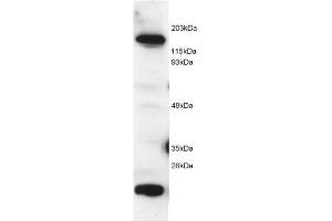 Image no. 1 for anti-5-Methyltetrahydrofolate-Homocysteine Methyltransferase (MTR) (C-Term) antibody (ABIN374080) (MTR Antikörper  (C-Term))
