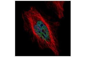 ICC/IF Image Confocal immunofluorescence analysis (Olympus FV10i) of paraformaldehyde-fixed HeLa, using DYRK1B, antibody (Green) at 1:500 dilution. (DYRK1B Antikörper  (N-Term))