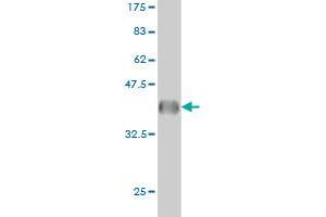 Western Blotting (WB) image for anti-Glutaminase (GLS) (AA 580-669) antibody (ABIN561056)